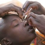 Onchocercose : le Togo engage la dernière phase vers l’interruption de la transmission d’ici 2030